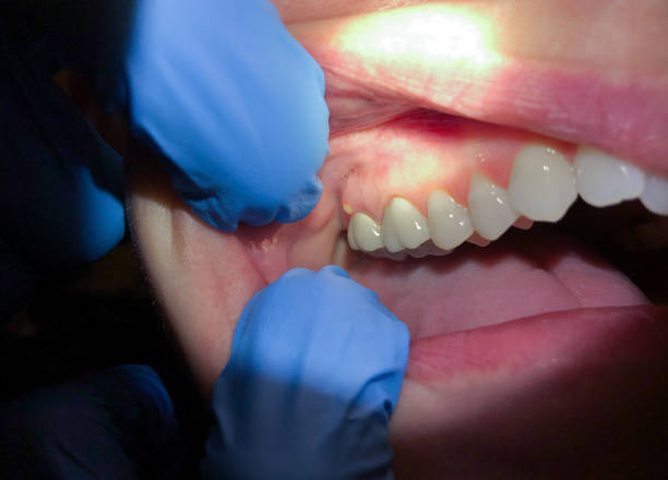 Best Emergency Treatment for Toothache in Sweeny, TX