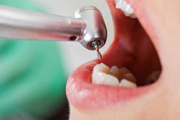 Best Emergency Dental Surgery in Sweeny, TX